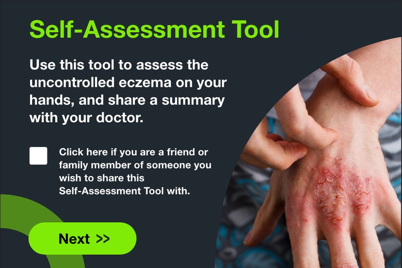 Start screen of the Hand Eczema Self-Assessment tool